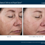 Alto Advanced Defense and Repair Serum Before and After 2